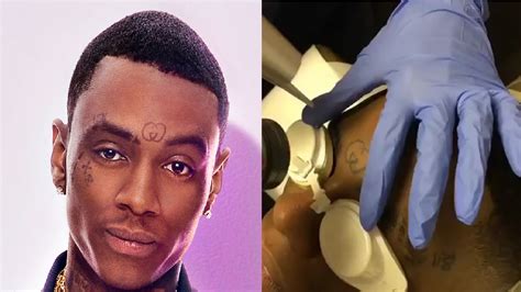 gucci face tattoo removed